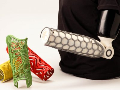 Myo myoelectric prosthetic arm